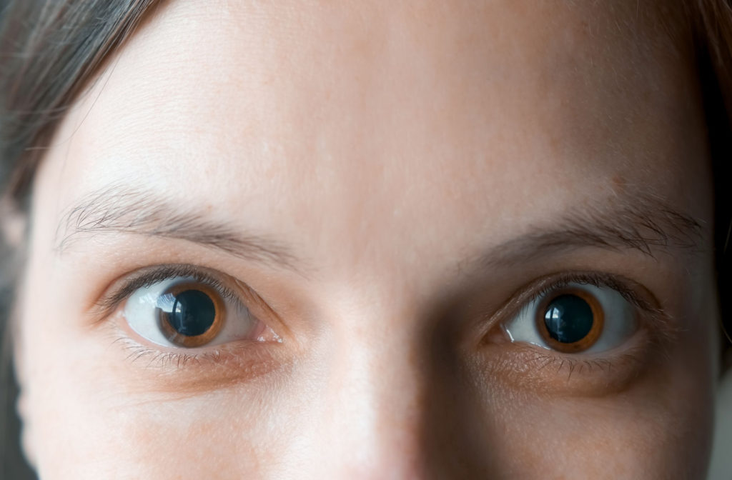 A close-up of a woman's dilated eyes.